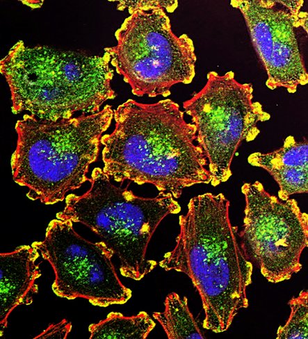 Bakterielle Inspiration gegen Krebs