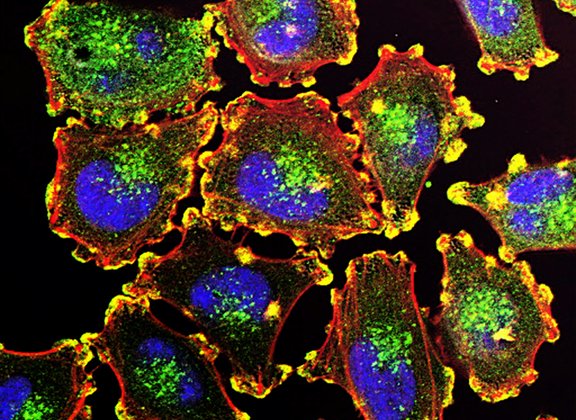 Bakterielle Inspiration gegen Krebs