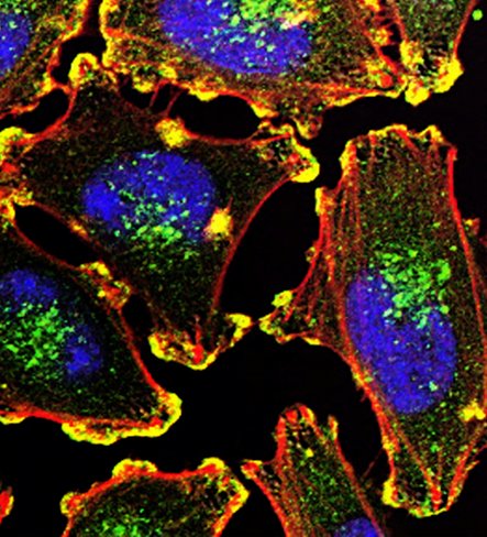 Using bacteria to fight cancer