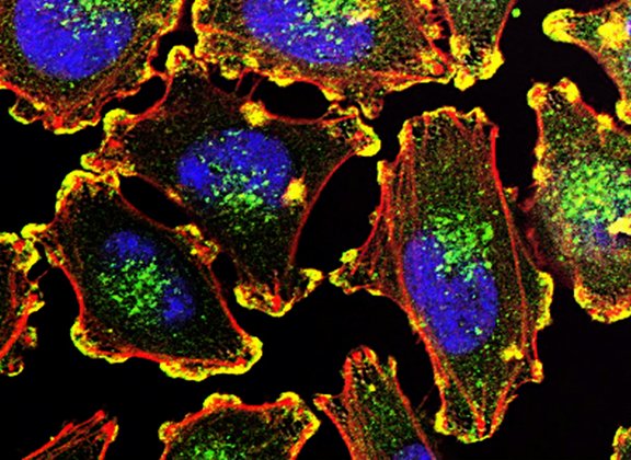 Using bacteria to fight cancer